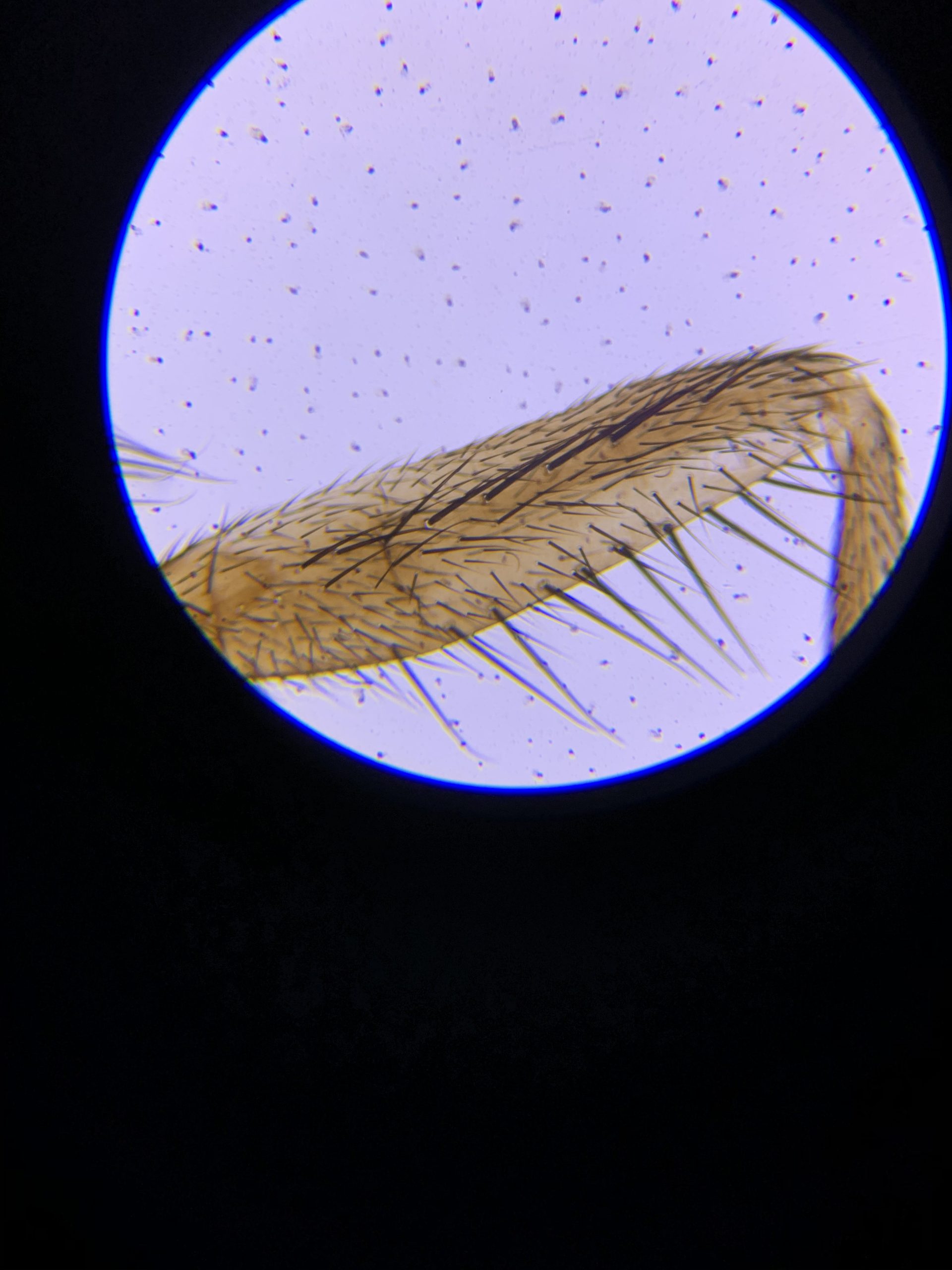 AmScope M162C-2L-PB10-WM Awarded 2018 Best Microscope Kit, 40X-1000X, All-Metal Construction customer photo 1