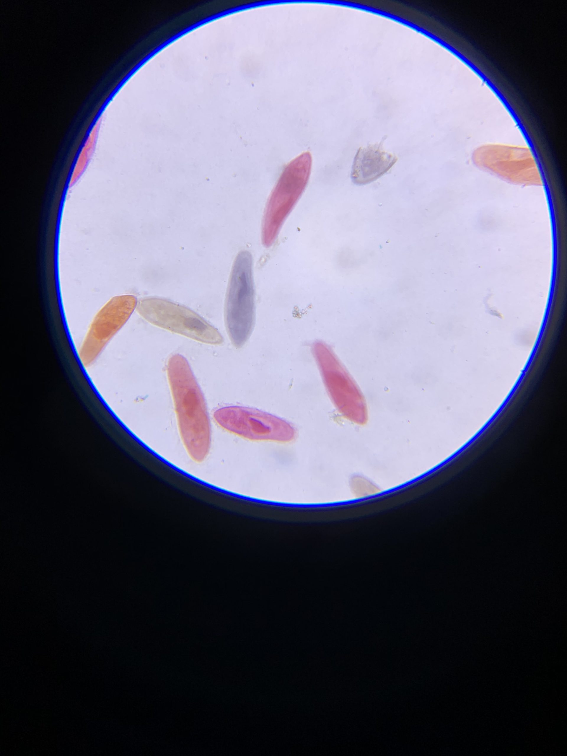 AmScope M162C-2L-PB10-WM Awarded 2018 Best Microscope Kit, 40X-1000X, All-Metal Construction customer photo 2